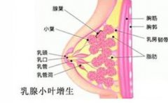 乳房肿块不会是乳腺癌的