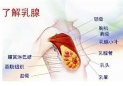 乳腺结节的护理工作怎么做